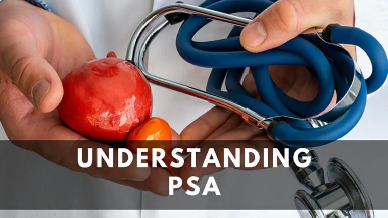 Understanding PSA